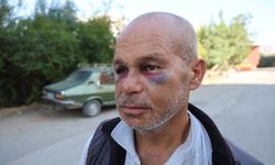 Kozan’da Engelli Adamı Darp Ettiler! Ailesi Şikayetçi Oldu