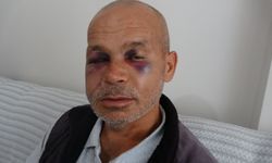 Kozan’da Engelli Adamı Darbeden Şüpheli Serbest Bırakıldı