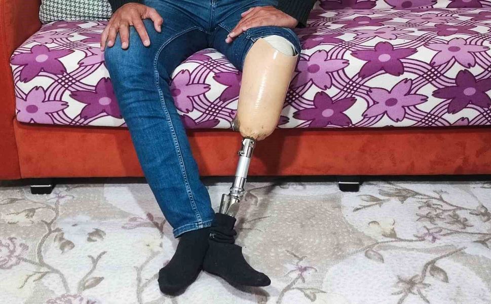 Alacağını Almak İçin IBAN Verdi, Cezaevine Girdi: Protez Bacaklı İşçi Dramı