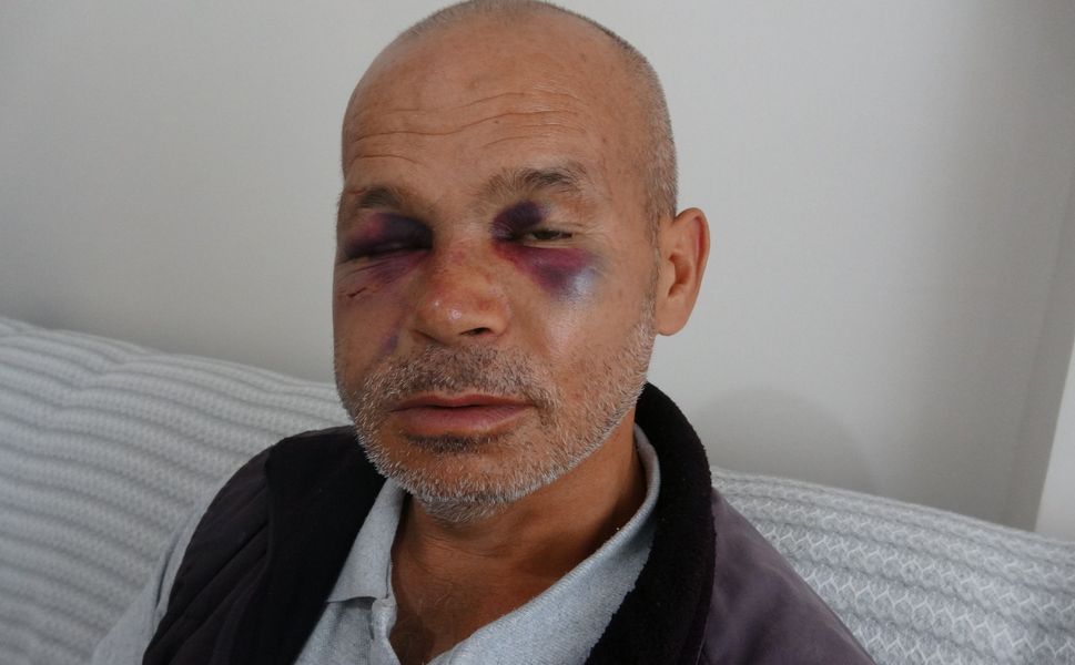 Kozan’da Engelli Adamı Darbeden Şüpheli Serbest Bırakıldı